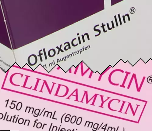 Ofloxacin vs Klindamicin